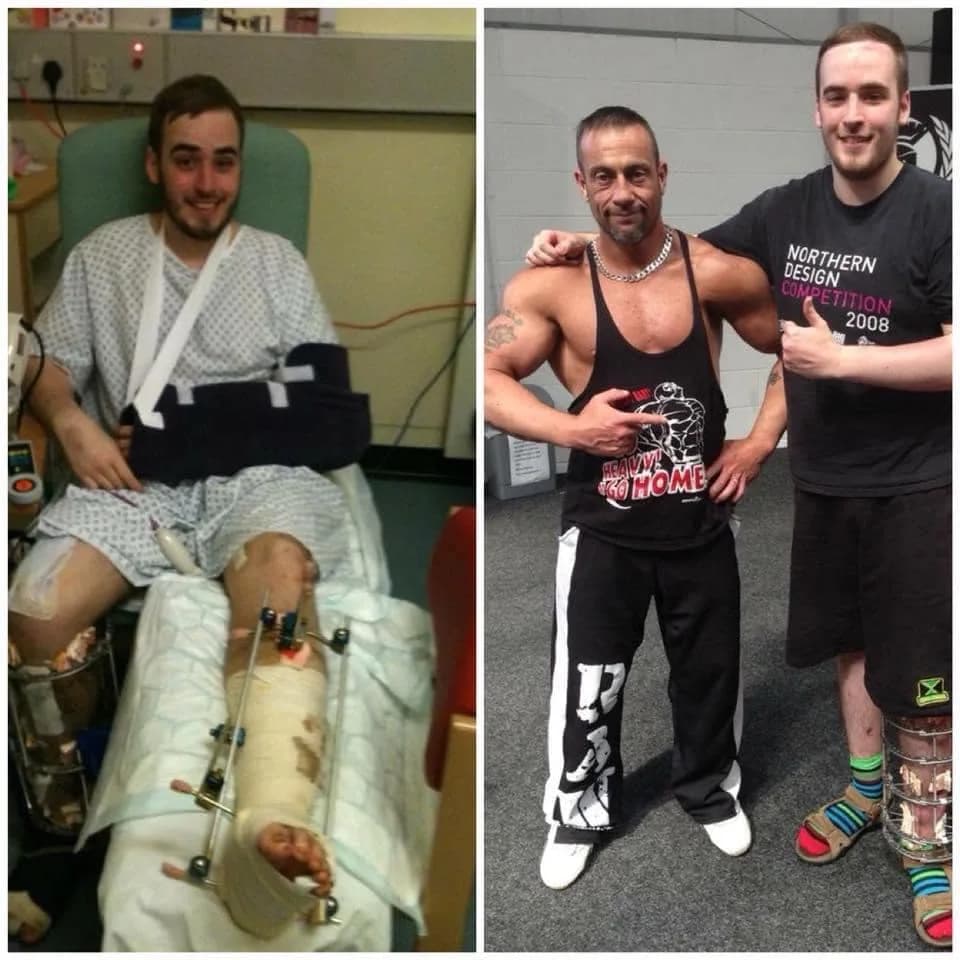 Before/after transformation 2